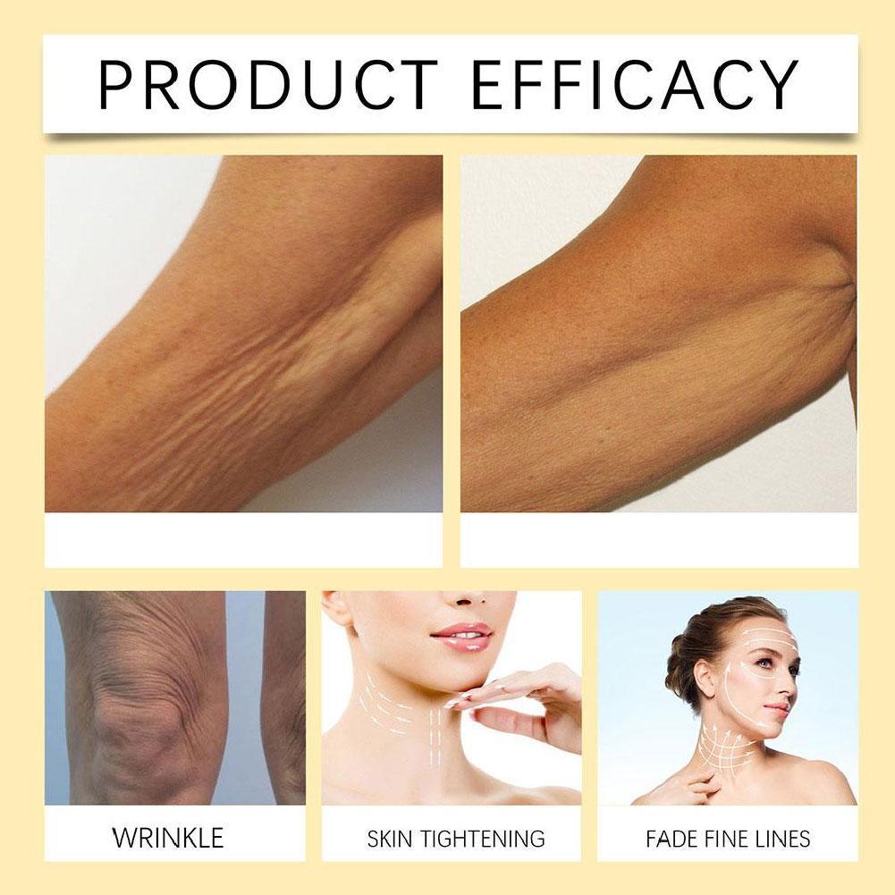 한국산 주름 개선 및 노화 방지 레티놀 아이크림, 다크 - Retinol Anti Wrinkle Cream 리뷰 및 가격