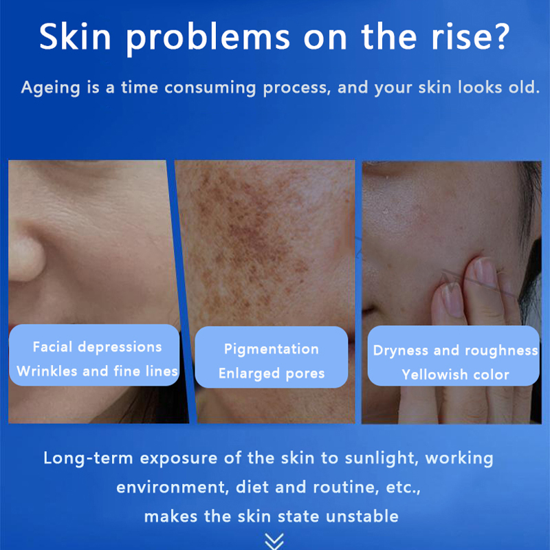페이스 블루 스펀지 미세조류 스킨 부스터 스킨케어 키트 - Hyaluronic Acid Facial Serum 리뷰 및 가격
